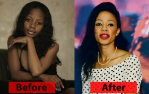 Black woman Dying to be White