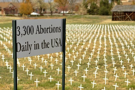 Babies have rights also and the right to life
